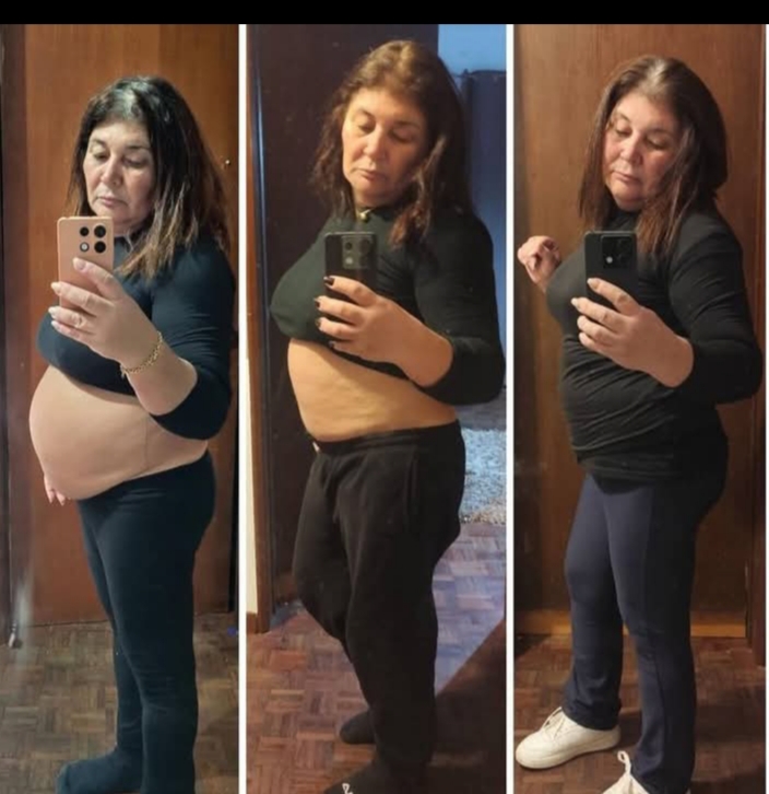 Antes e depois — Ana Valle